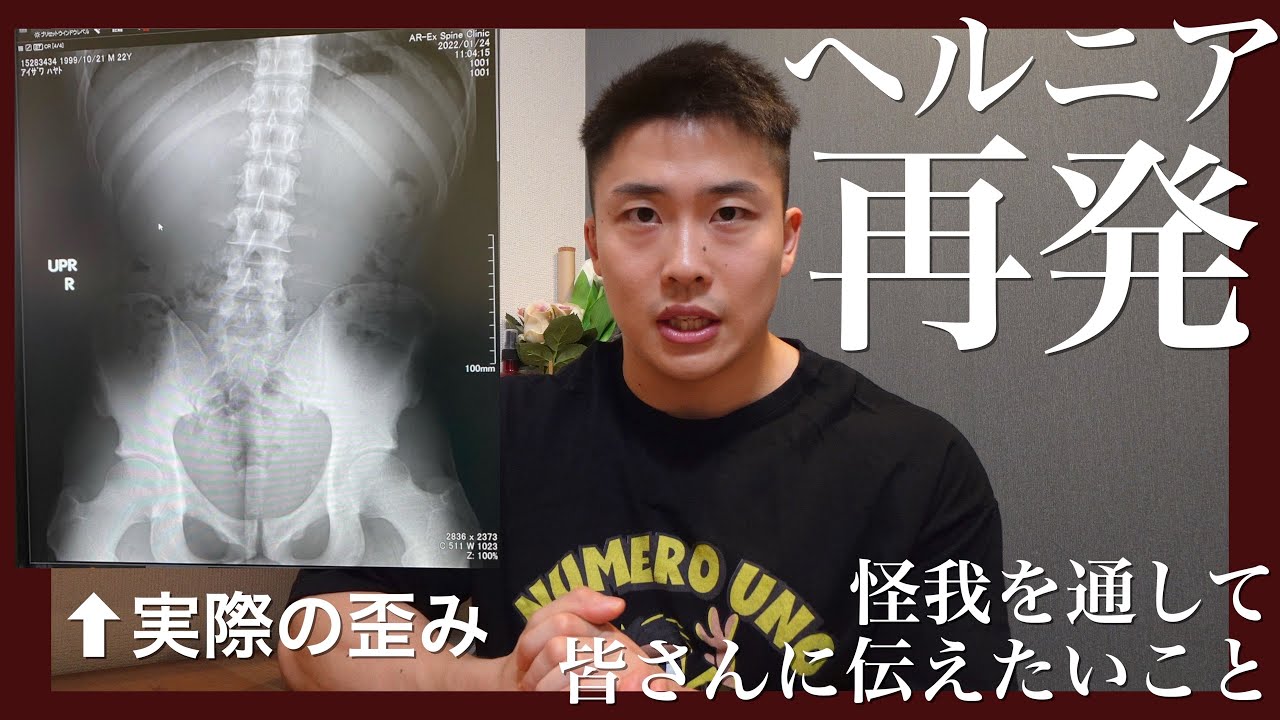 みなさん、これは気をつけてください。