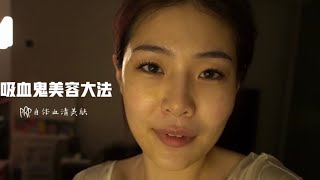 比水光针还安全有效的医美项目——PRP自体血清美肤/注射/水光金卡戴珊全家都在做“无所不能”水光针