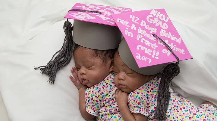 Nurses celebrate preemie babies graduation from NICU