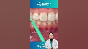 Hành trình niềng răng |Dr Cường Official