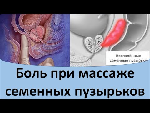 Боль при массаже семенных пузырьков
