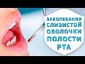 Тактика врача-стоматолога при заболеваниях слизистой оболочки полости рта| Дентал ТВ