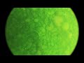 Many Marimo moss balls under the Lake Akan
