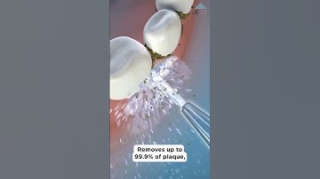 The MUST HAVE device if you hate flossing! Floss your teeth in 60 seconds 💦 #shorts