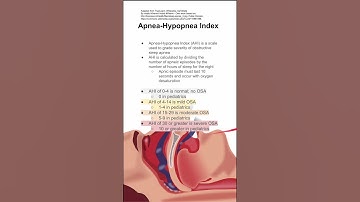 Apnea-Hypopnea Index