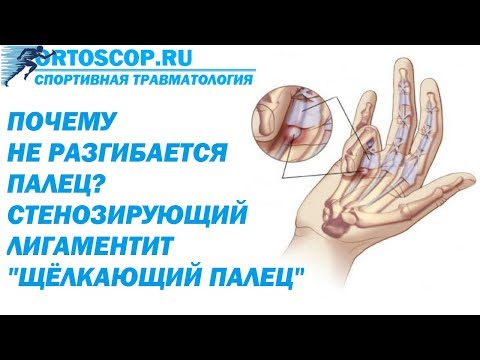 Видео: Тесьма пальцев: причины и методы лечения