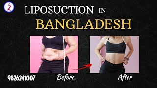 Liposuction In Bangladesh | Liposuction Surgery Procedure And Cost In Bangladesh | 2023.