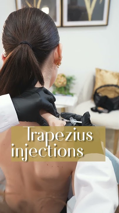 "Trap Tox" - BOTOX into the trapezius muscle - YouTube