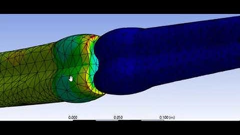 FEA analysis of knee joint without cartilage and meniscus for biomedical simulation in biomechanics