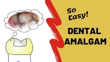 Dental Amalgam | Incredibly Easy!