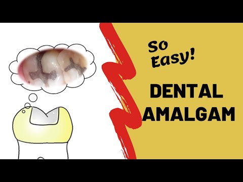 Dental Amalgam | Incredibly Easy!