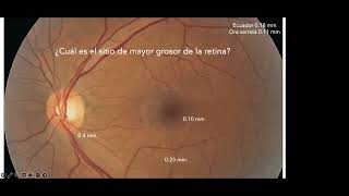 ANATOMÍA Y FISIOLOGÍA DE RETINA. MÓDULO RETINA