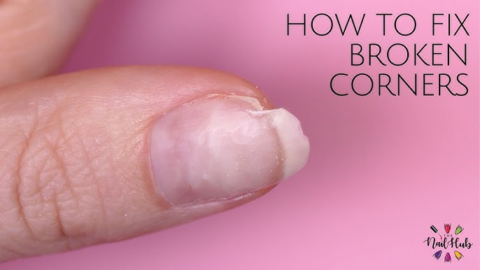 How to Fix Peeling Nails – glamnetic