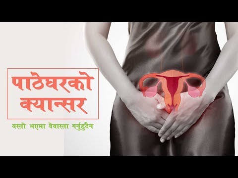 पाठेघरको क्यान्सर |एस्तो भएमा बेवास्था गर्नु हुँदैन | Cervical Cancer | 10 Warning Sign | Self Care