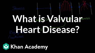 What is valvular heart disease? | Circulatory System and Disease | NCLEX-RN | Khan Academy