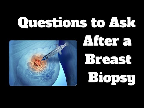 Questions To Ask After A Breast Biopsy