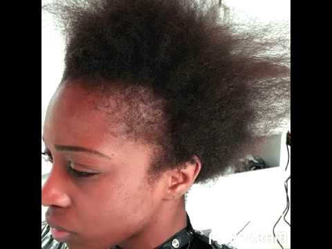 Black Hairstyles For Thin Edges