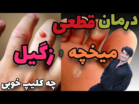 تصویری: 4 راه درمان تاول های پوستی