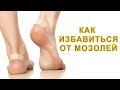 КАК БЫСТРО ИЗБАВИТЬСЯ ОТ МОЗОЛЕЙ НА НОГАХ