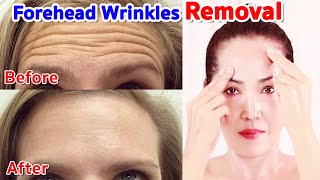 Forehead  Wrinkles Removal | NO TALKING | Facial Massage Anti Aging