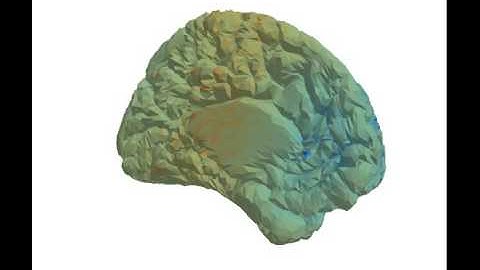 Delayed neural field on cortical surface