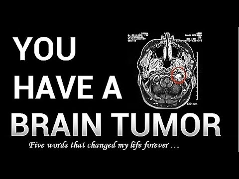 My ACOUSTIC NEUROMA Story | BRAIN TUMOR Symptoms, diagnosis, treatment | VESTIBULAR SCHWANNOMA