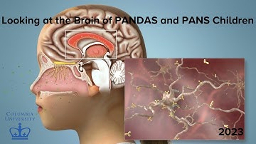 Looking at the Brain of PANDAS and PANS Children