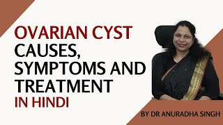 OVARIAN CYST ओवरी में गाँठ (HINDI)कारण, लक्षण और इलाज