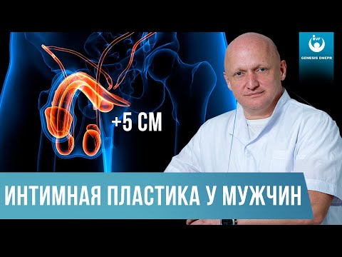 Увеличение полового члена. Интимная пластика для мужчин | Хирург высшей категории Шевцов А.Н.