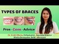 Types of Braces - Pros and Cons of Metal Braces | Dental Braces for your Teeth |  ब्रेसेस के प्रकार