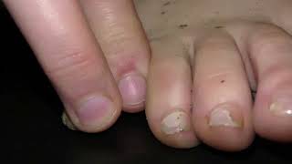 Sweaty Feet, Toe Jam And Natural Sweaty Dirt