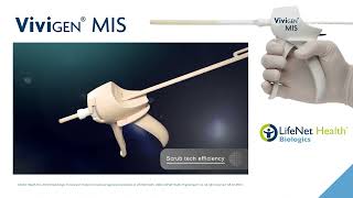 Dr. Deepak Reddy on using ViviGen® MIS Delivery System