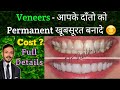 Dental veneers cost in india  veneers     very fast treatment for beautiful smile 