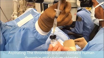 Fibrin Glue (TISSEEL) Preparation