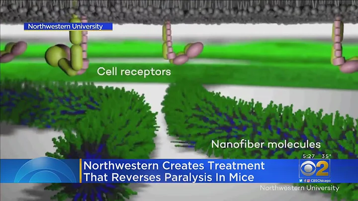 Northwestern Researchers Develop Possible Treatment For Paralysis