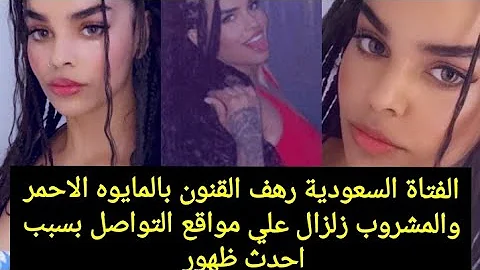 رهف القنون بعد التجميل