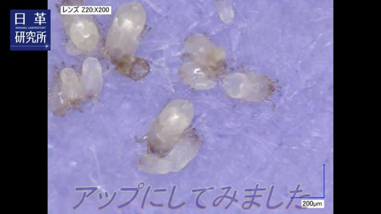 日革研究所 716_ヒョウヒダニってどんなダニ?_チリダニその2_SFR - YouTube