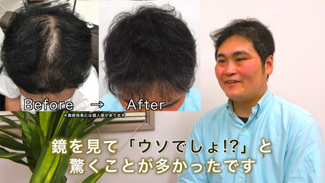 お客様の発毛 頭皮改善の事例と頂いた感想 盛岡市の発毛サロンrise ライズ