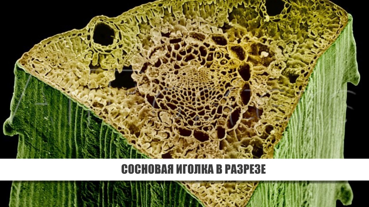 Ткань хвойных. Срез листа под микроскопом. Сибирский Хермес под микроскопом. Устьица в микроскопе. Хвоя сосны в микроскоп.