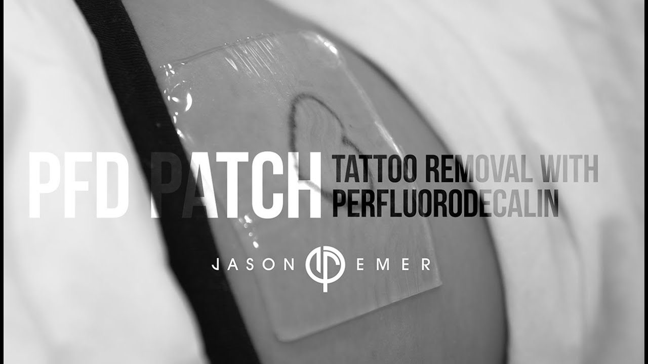 Faster Results Using the Describe PFD Patch for Laser Tattoo Removal   Connecticut Tattoo Removal