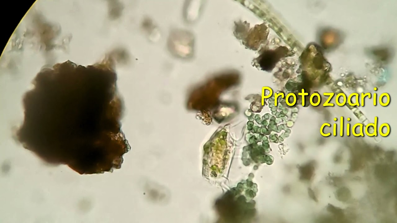 OBSERVACIÓN DE PROTOZOARIOS