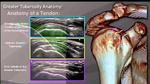 Webinar: Diagnostic Shoulder Ultrasound Exam - Part 2