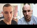 Going bald shaving your head doesnt help   bald cafe podcast episode 11