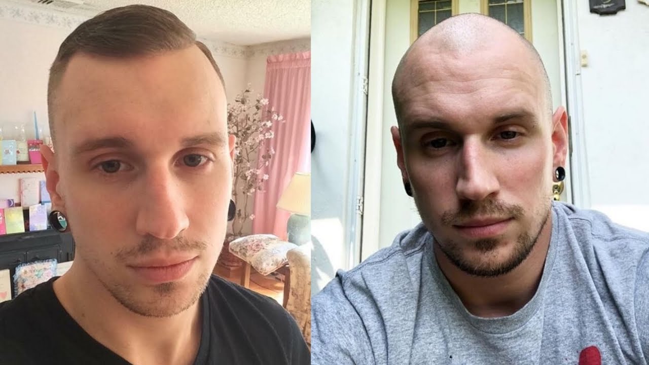 GOING BALD "SHAVING YOUR HEAD DOESN'T HELP?",  - Bald Cafe podcast episode 11