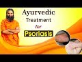 Ayurvedic Treatment for Psoriasis | Swami Ramdev