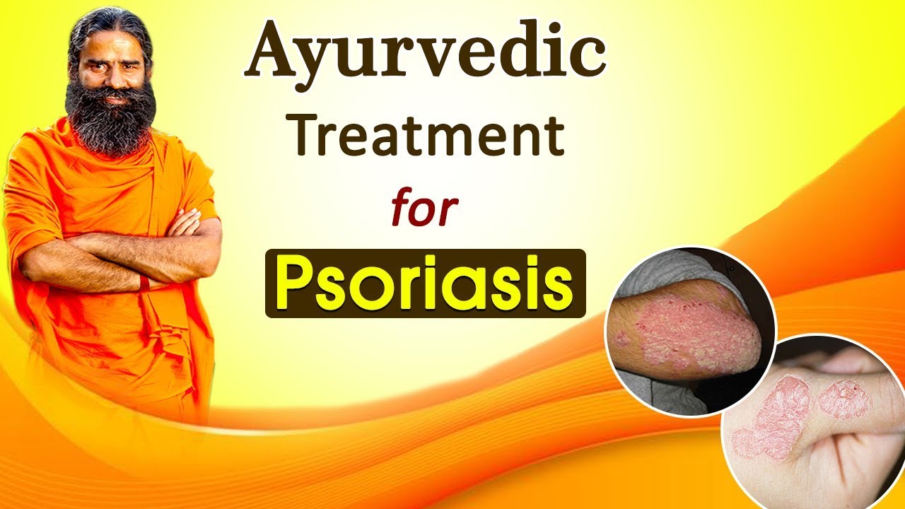 scalp psoriasis treatment in ayurveda