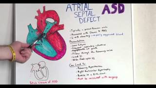 Atrial Septal Defect - Anatomy Lecture for Medical Students - USMLE Step 1