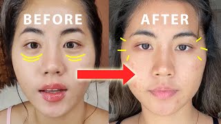 Tips AMPUH Atasi Mata Panda | LACOCO Intensive Treatment Eye Serum