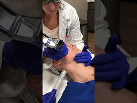 Sciton MicroLaser Peel