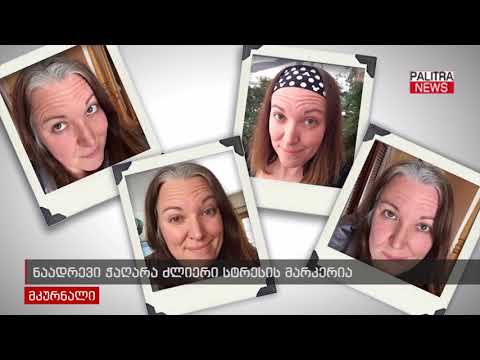 ნაადრევი ჭაღარა ძლიერი სტრესის მარკერია